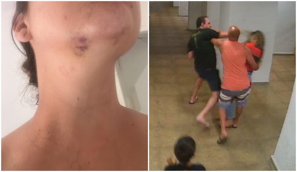 Homem agride vizinha com chute no rosto durante briga em condomínio de Guarulhos, na Grande SP