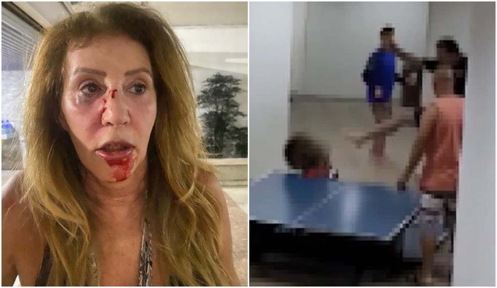 Mãe de agressor diz ter apanhado de vizinha que levou chute no rosto: ‘Meu filho me viu sangrando e foi tirar satisfação’